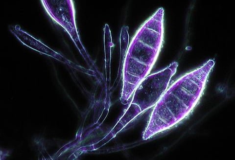 Microsporum canis