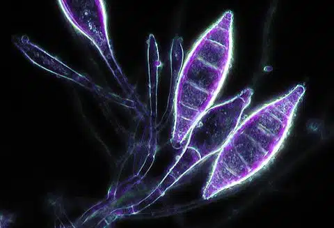 Microsporum canis
